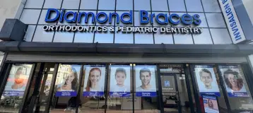 Diamond Braces