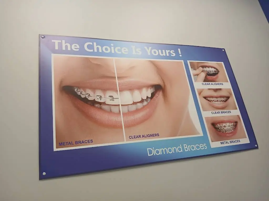 Diamond Braces