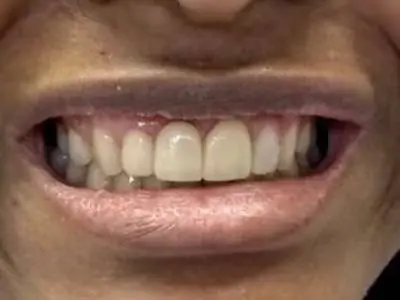 Smile Savers Cosmetic Dental