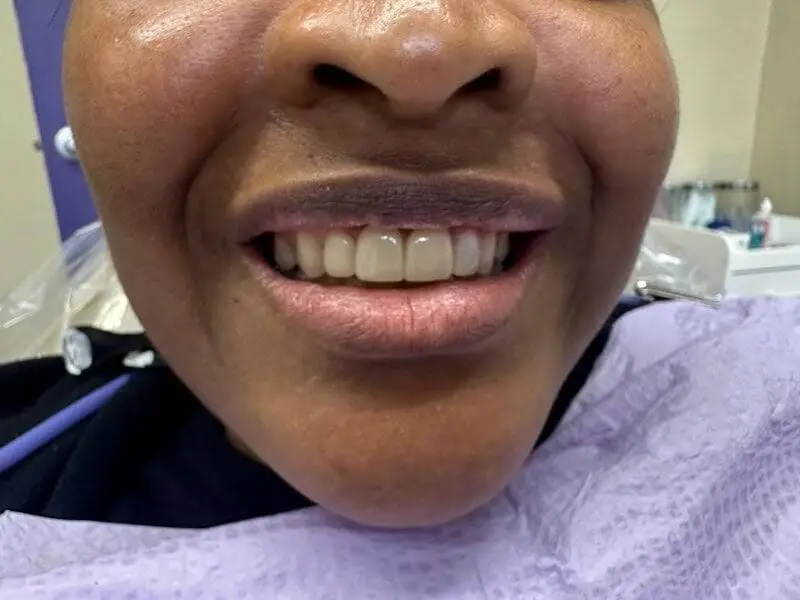 Smile Savers Cosmetic Dental
