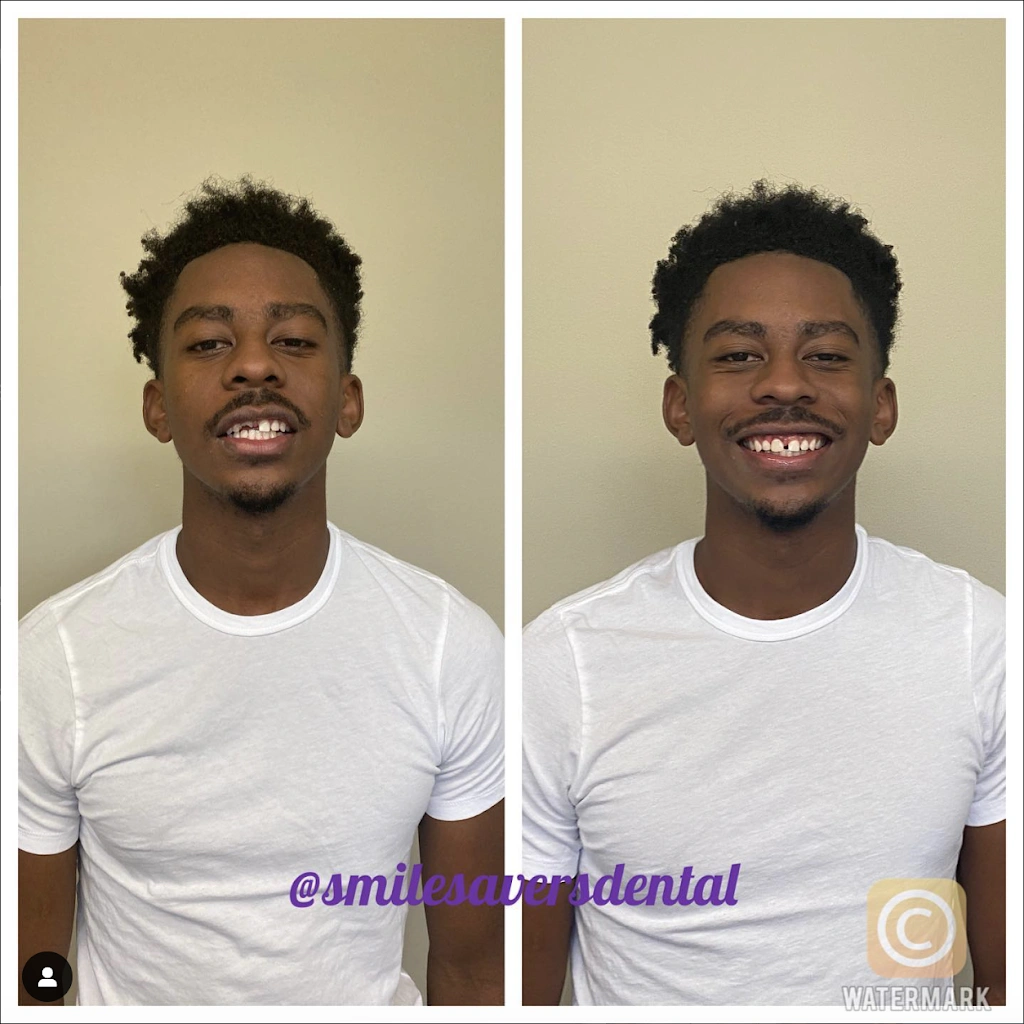 Smile Savers Cosmetic Dental