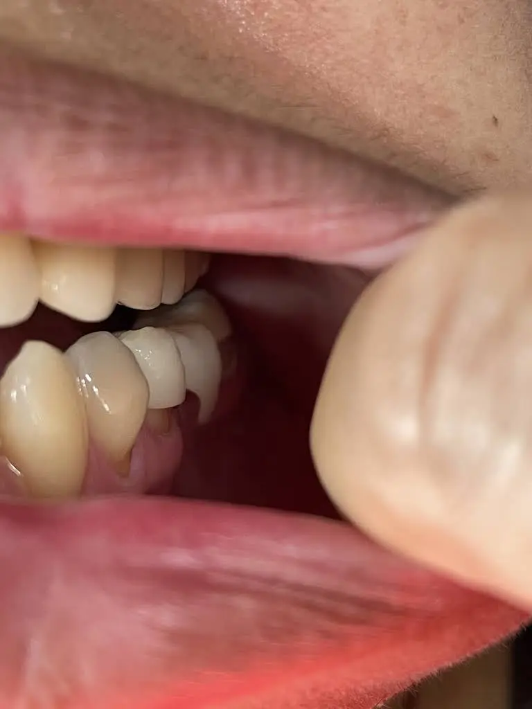 Prime Dental Partners of Sheepshead Bay
