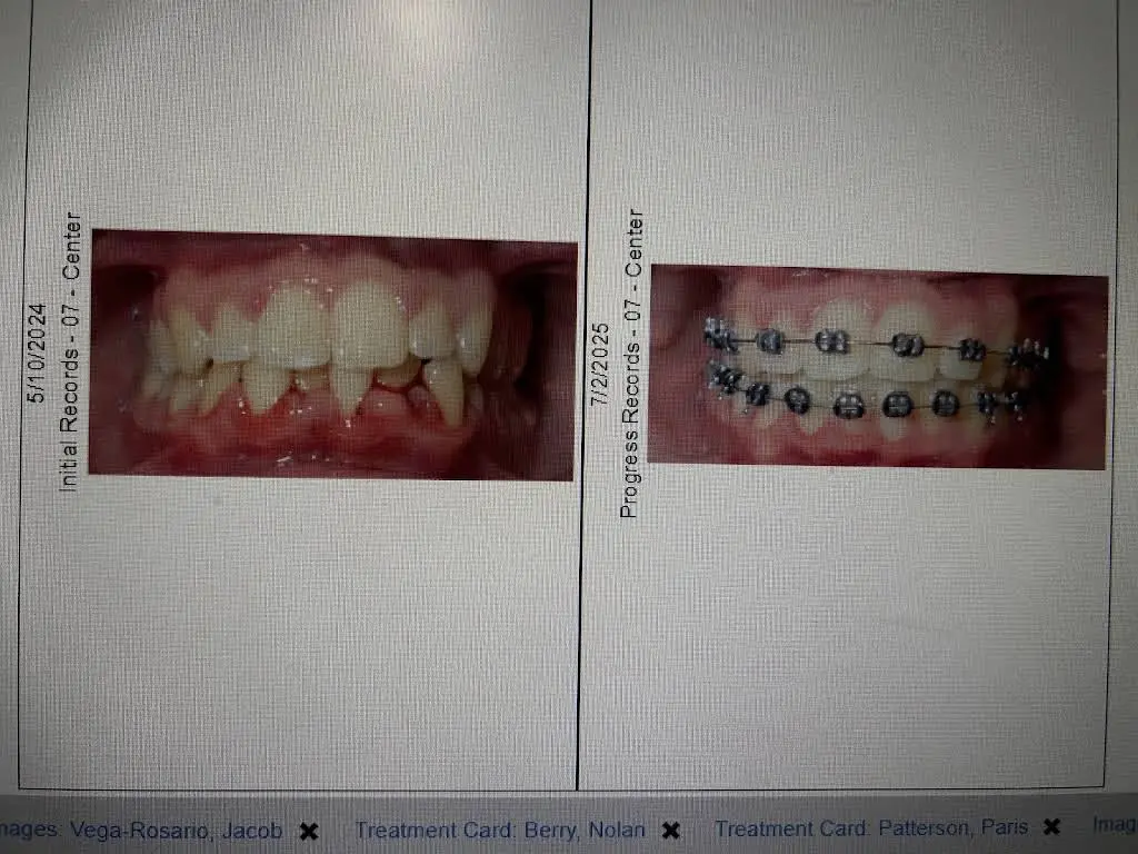 MyFamily Braces Orthodontics