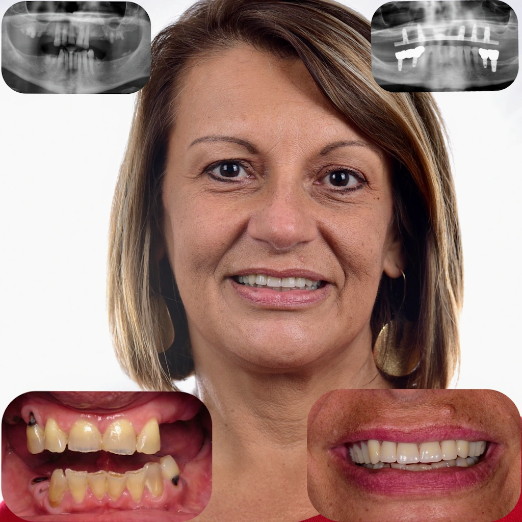 Bullard Dental - Professional dental clinic exterior with modern facilities