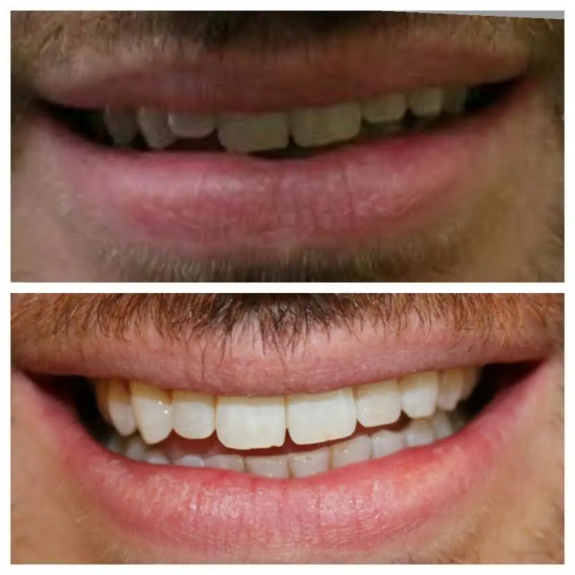Altman Dental