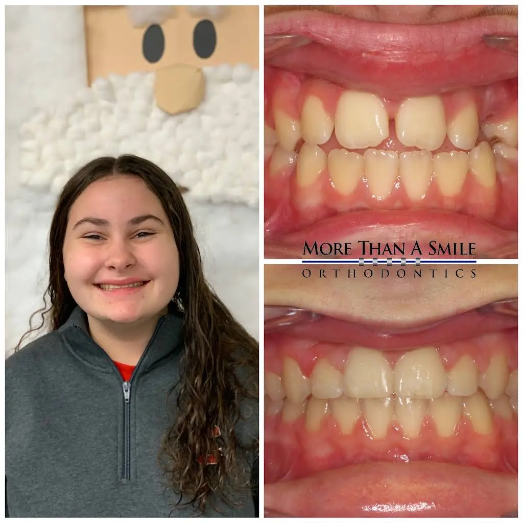More Than A Smile Orthodontics
