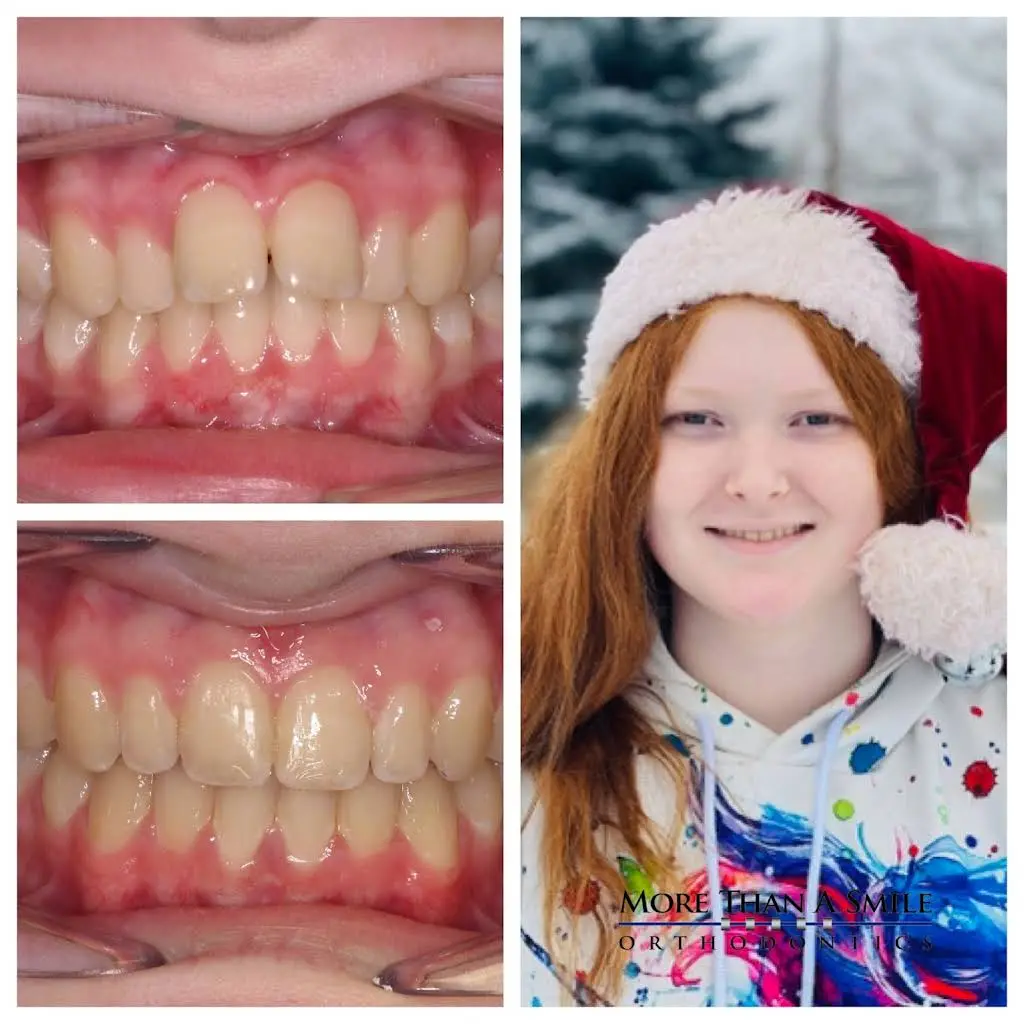 More Than A Smile Orthodontics