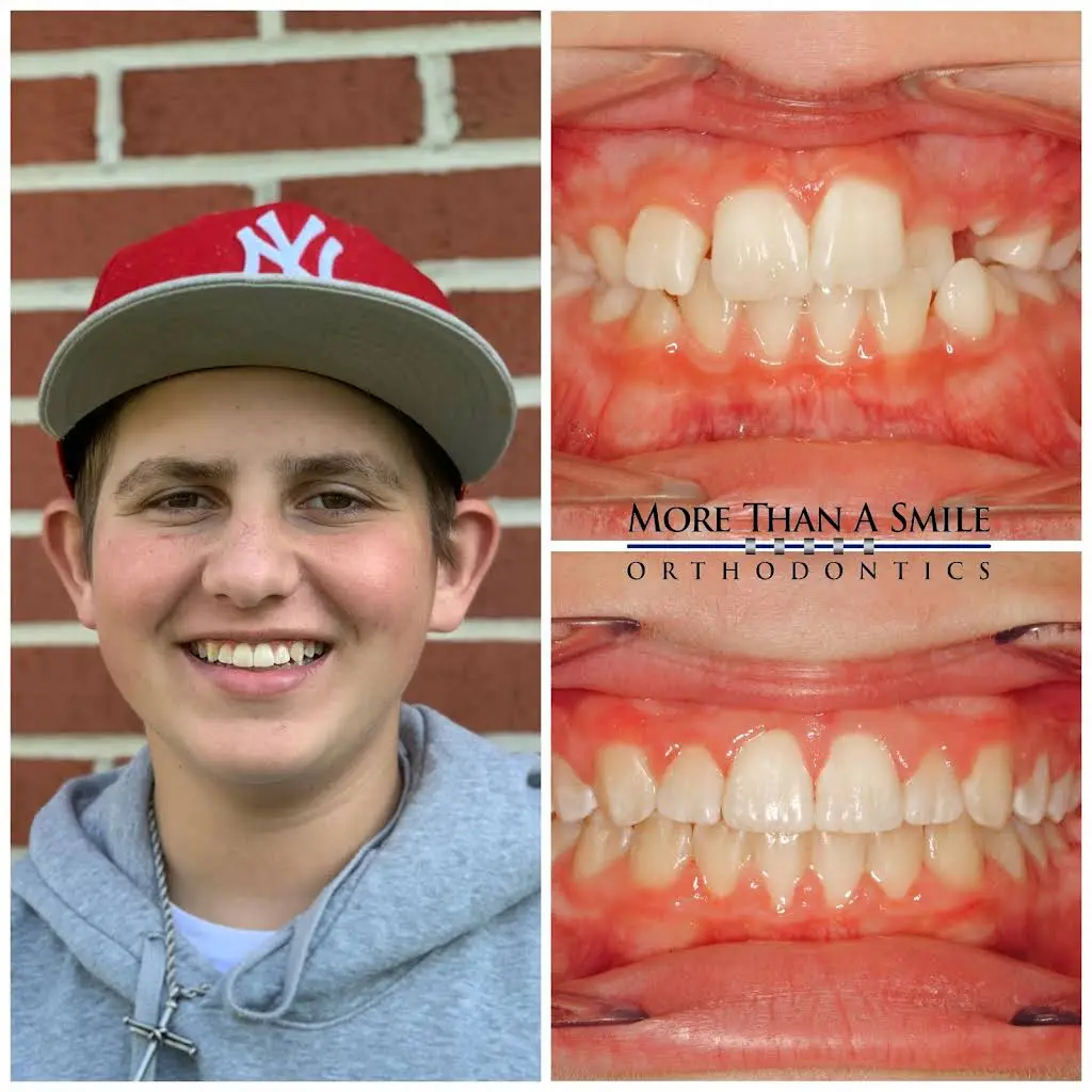 More Than A Smile Orthodontics