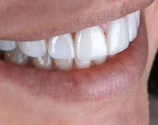 Donald A. Tucker, DDS