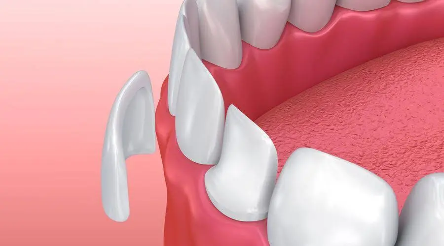 Donald A. Tucker, DDS