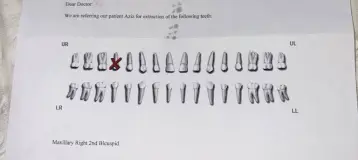 UB Oral & Maxillofacial Surgery