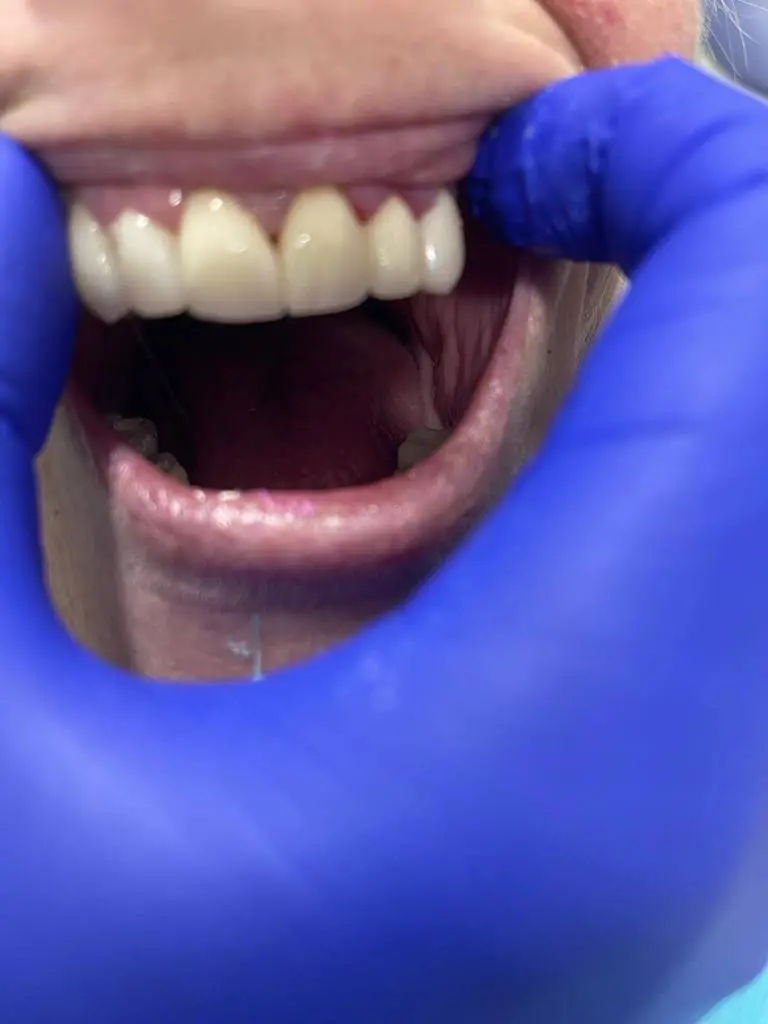 ACE Dental