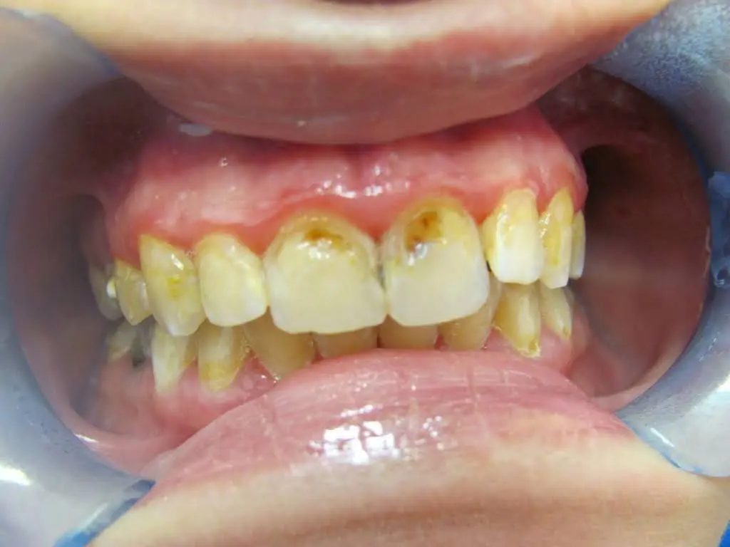 Brunswick Dental Associate