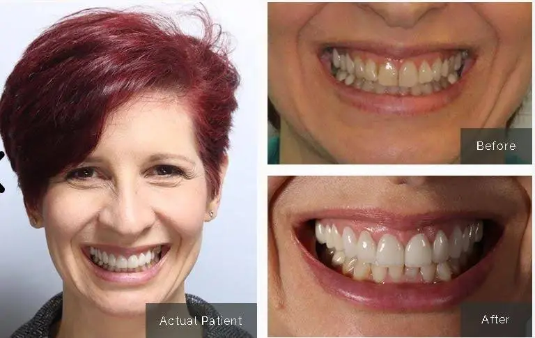S Plainfield Family Dental