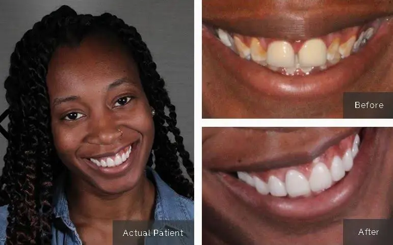 S Plainfield Family Dental