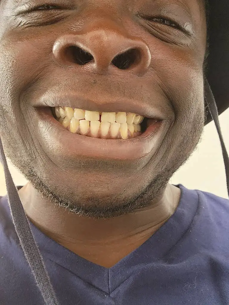 Smiling Molar Dental