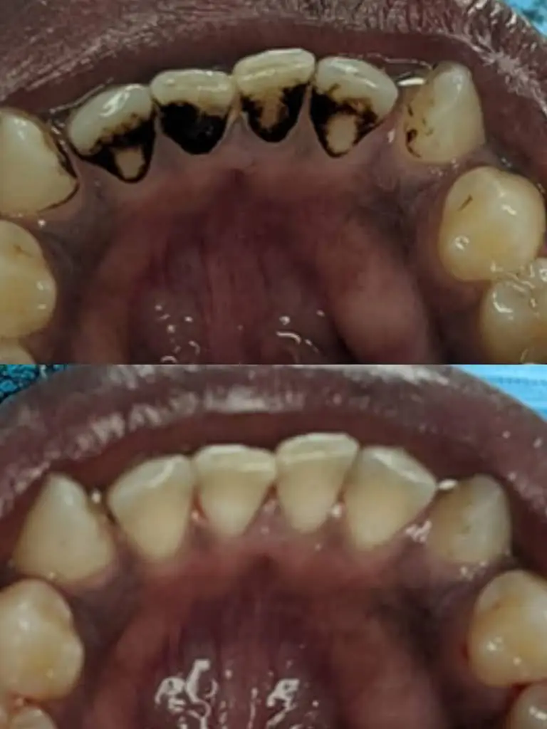 Jace Dental