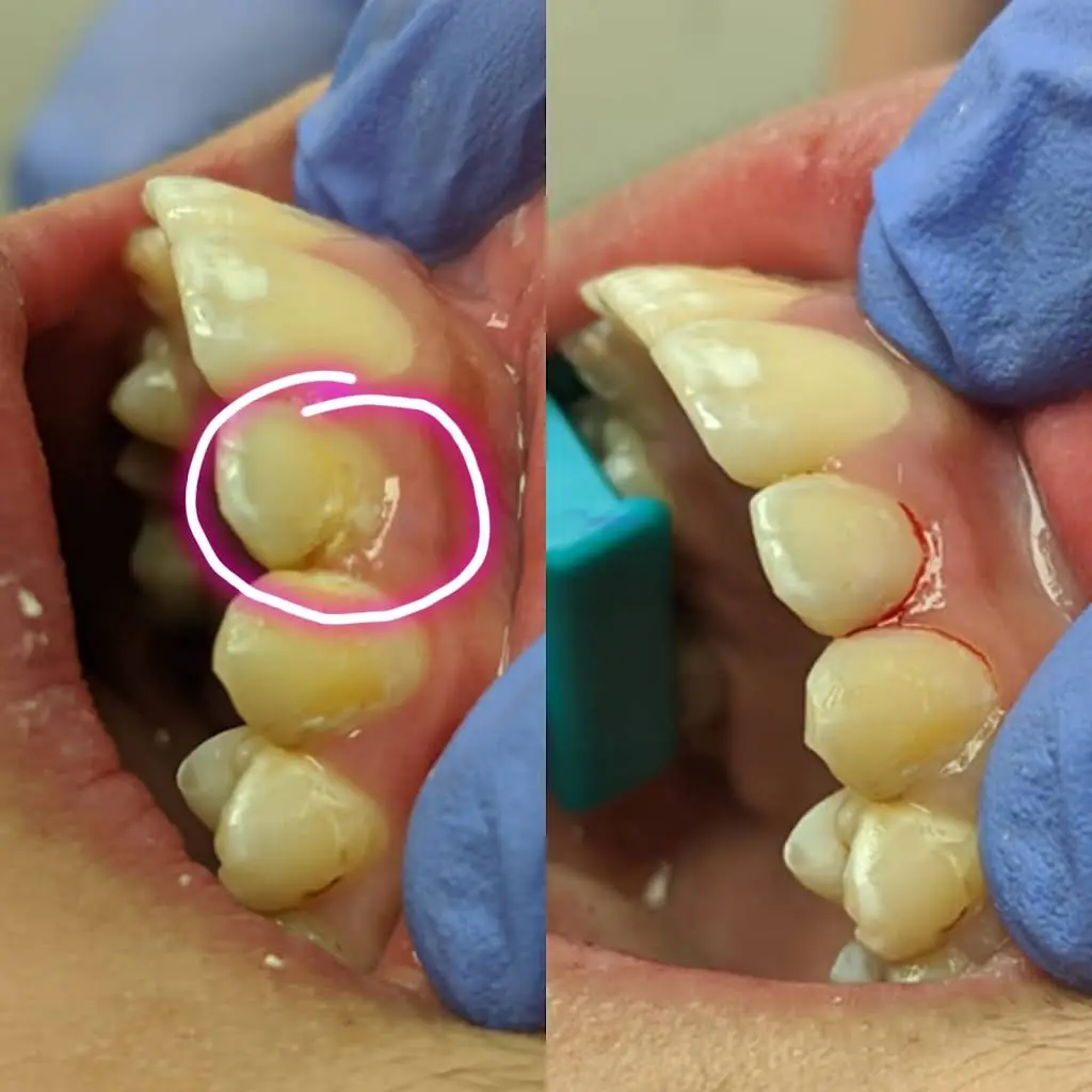 Jace Dental