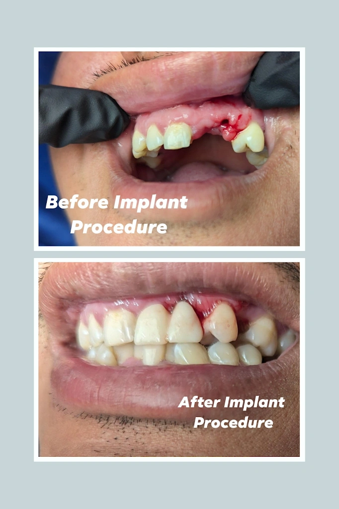 Jace Dental