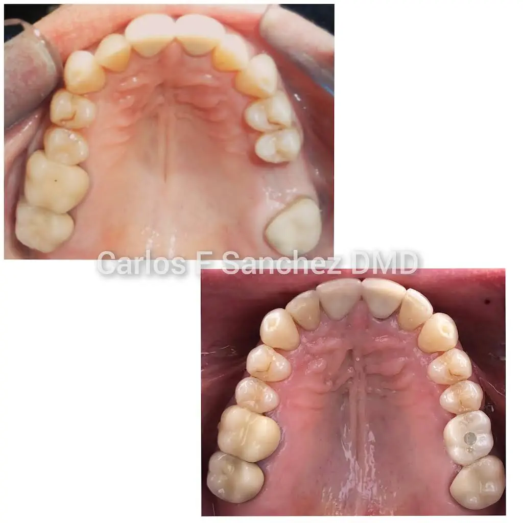 Penndel Dental -- Carlos F. Sanchez DMD