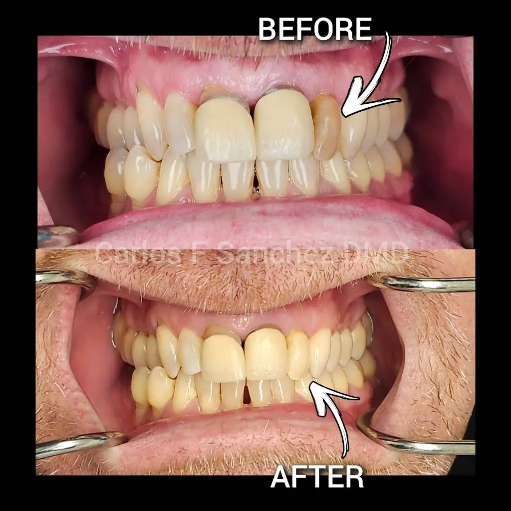 Penndel Dental -- Carlos F. Sanchez DMD