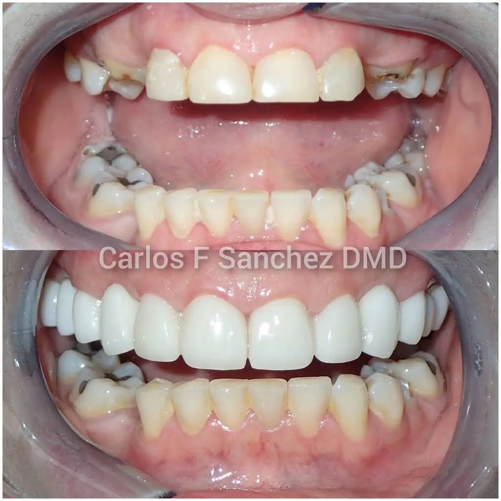 Penndel Dental -- Carlos F. Sanchez DMD