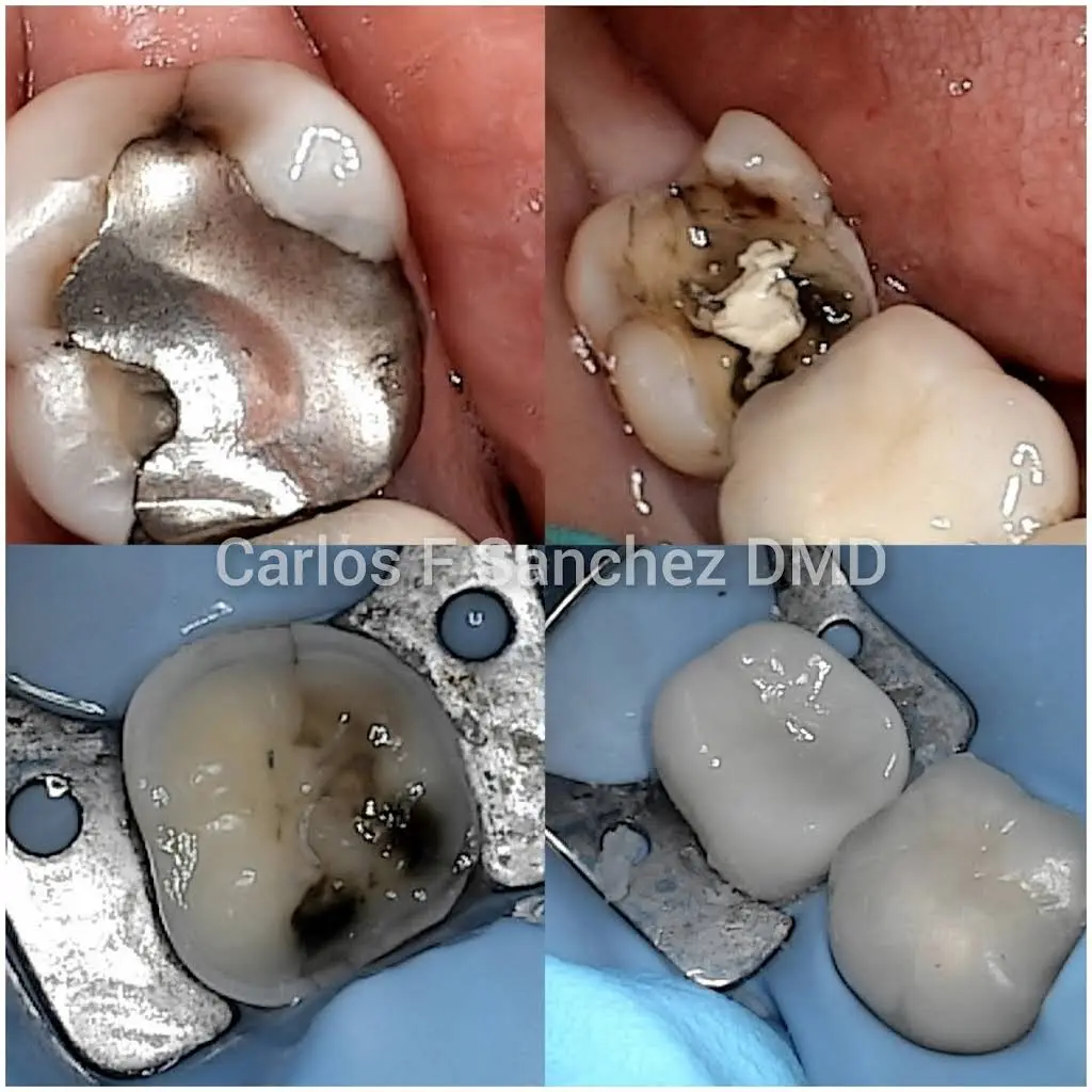 Penndel Dental -- Carlos F. Sanchez DMD