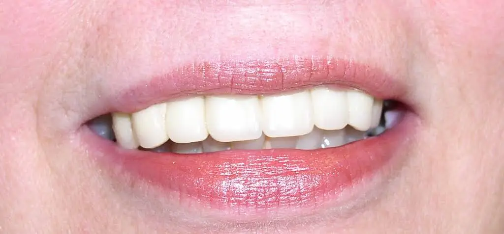 Brent Dental Arts