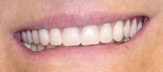 Brent Dental Arts