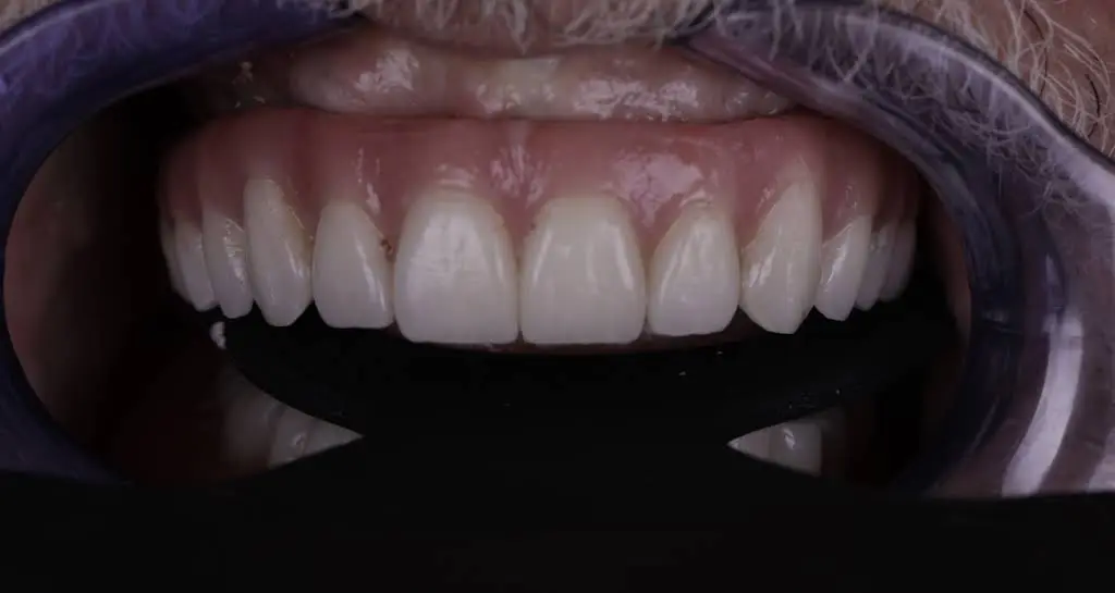 Pleasant Valley Family and Cosmetic Dentistry