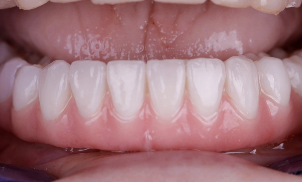 Pleasant Valley Family and Cosmetic Dentistry