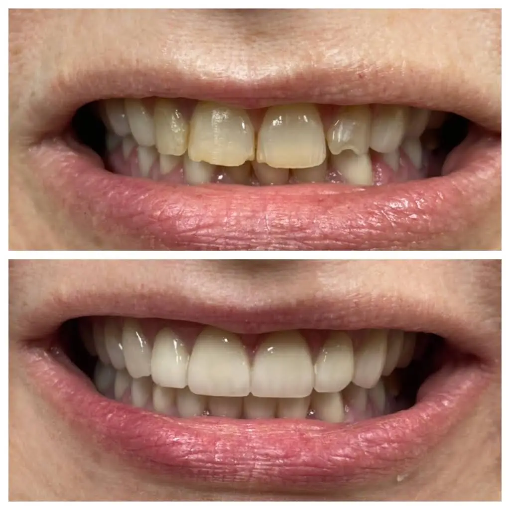 Neshaminy Valley Dentistry