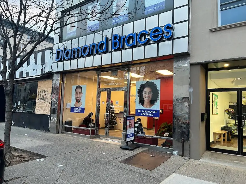 Diamond Braces