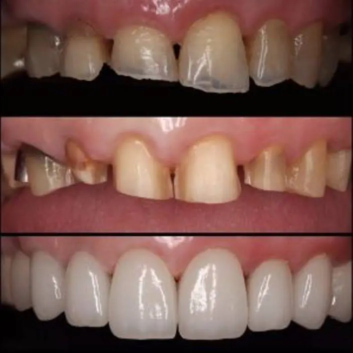 iSmile Dental