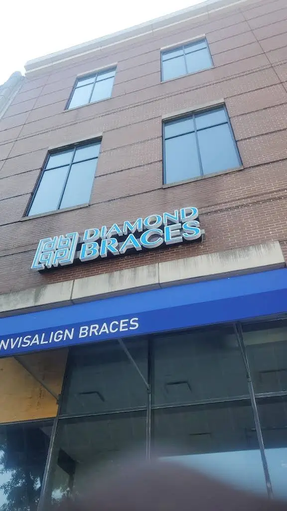 Diamond Braces