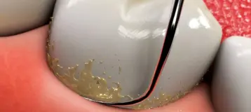 Horizon Dental Arts PC
