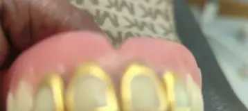 Affordable Dentures & Implants