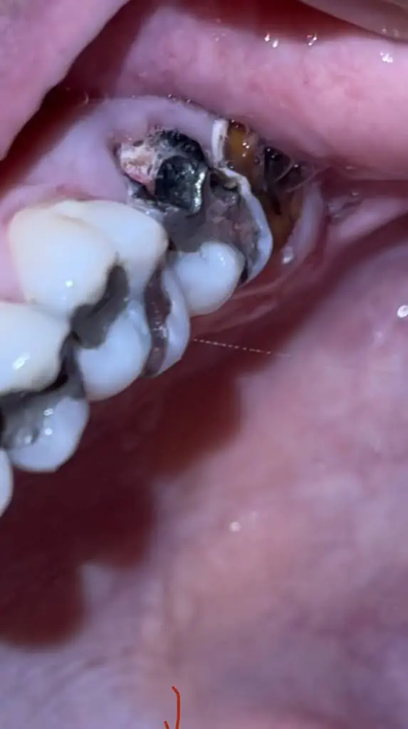 Aspen Dental