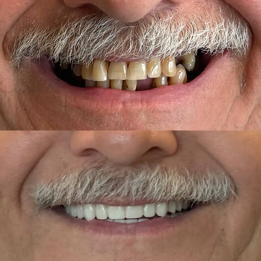 Buffalo General Dentistry