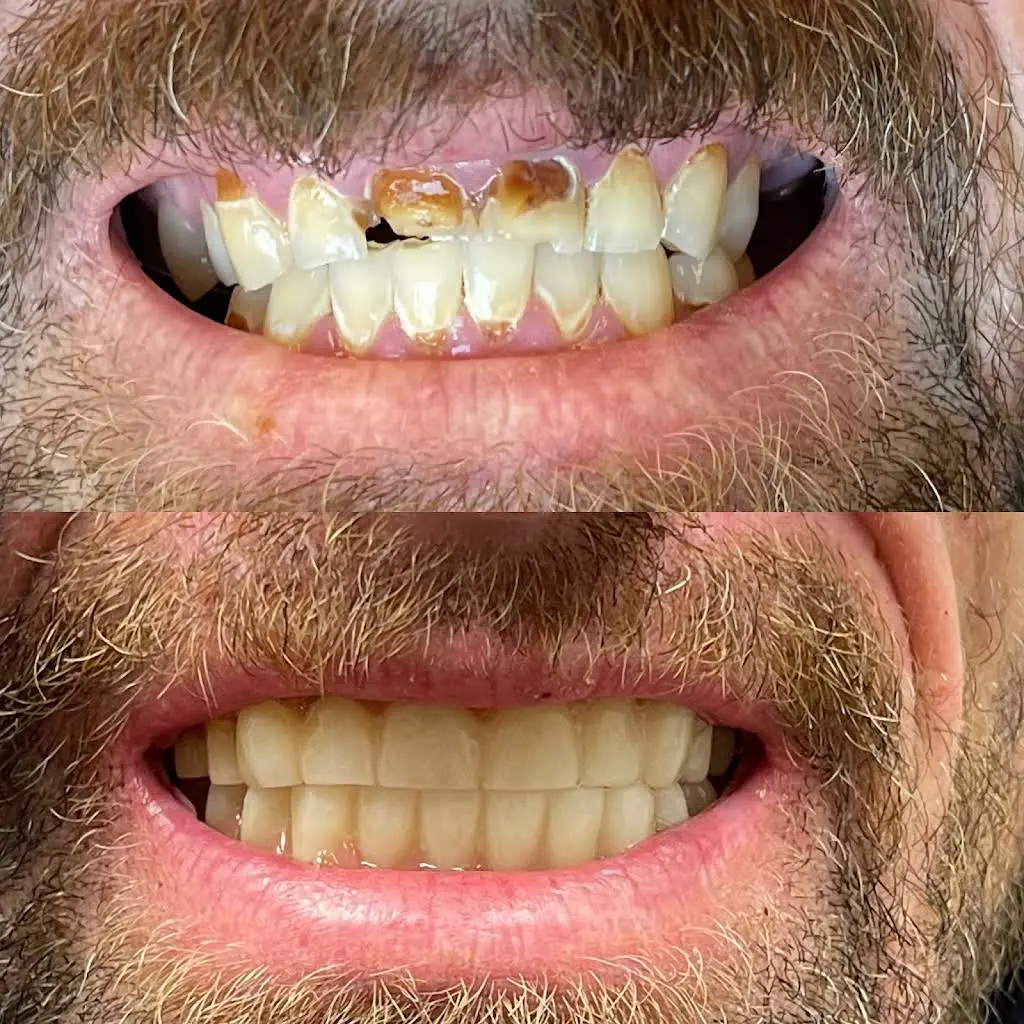Buffalo General Dentistry