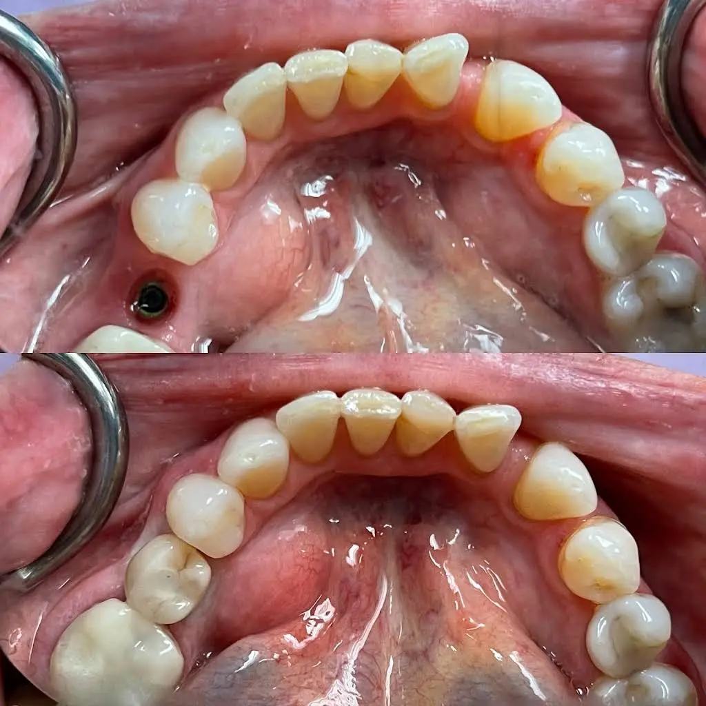 Buffalo General Dentistry