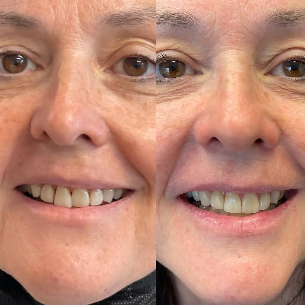 Buffalo General Dentistry