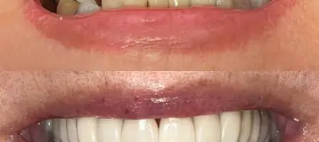 Buffalo General Dentistry