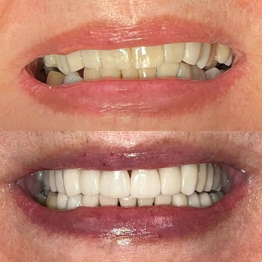 Buffalo General Dentistry - Professional dental clinic exterior with modern facilities