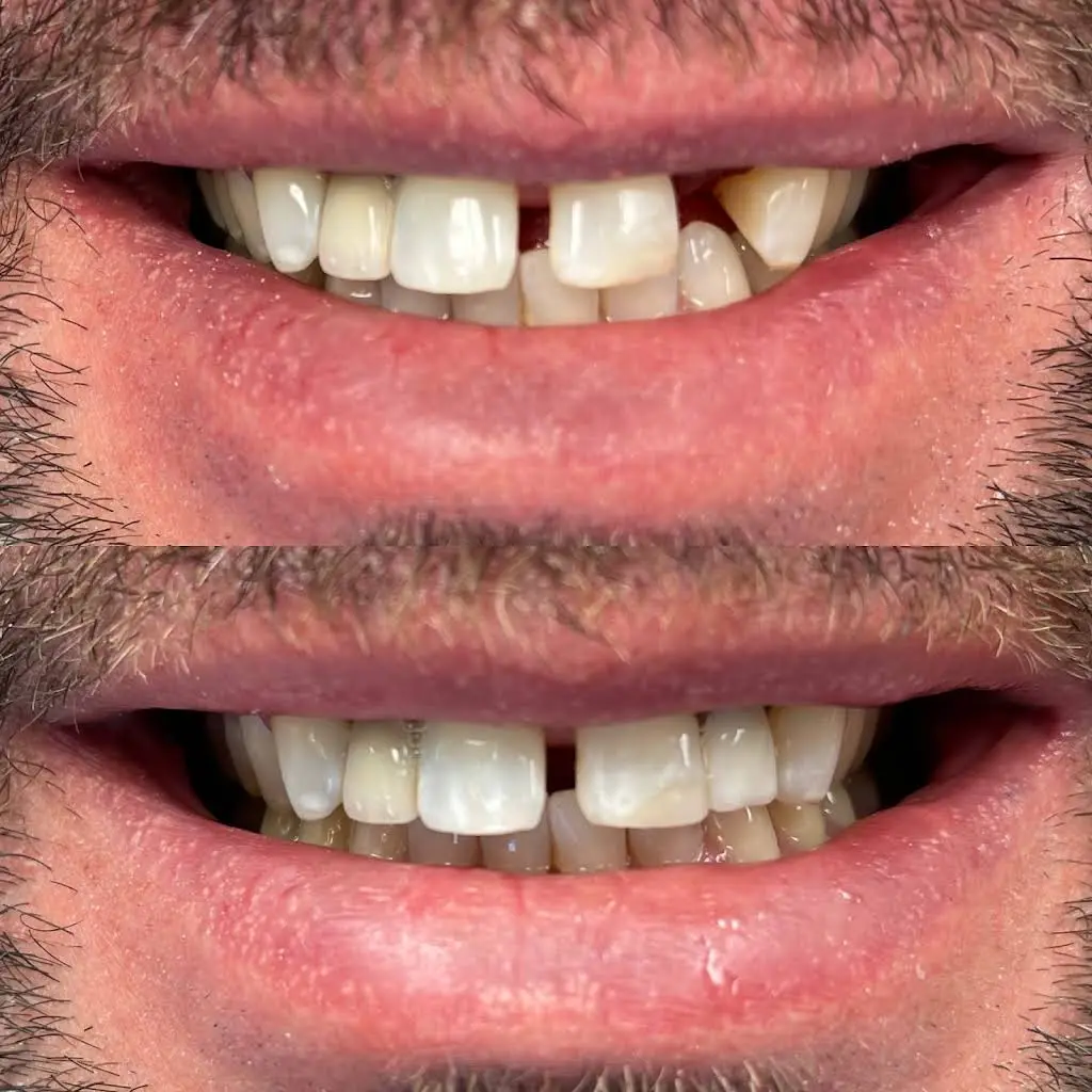 Buffalo General Dentistry