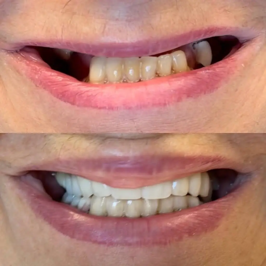 Buffalo General Dentistry