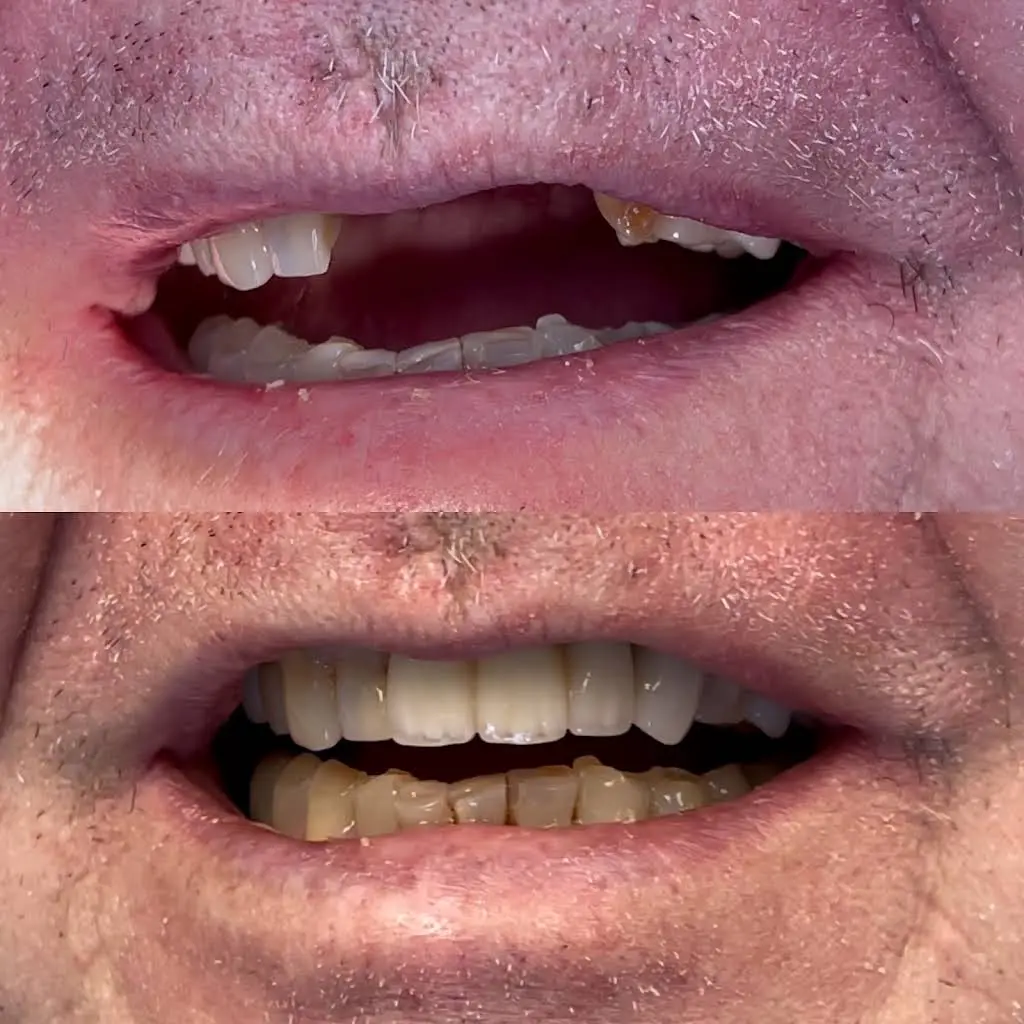 Buffalo General Dentistry