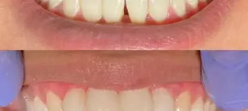 Zen Dental