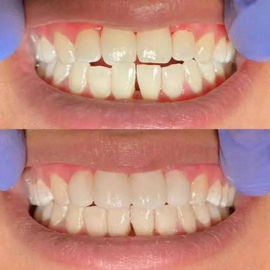 Zen Dental - Professional dental clinic exterior with modern facilities