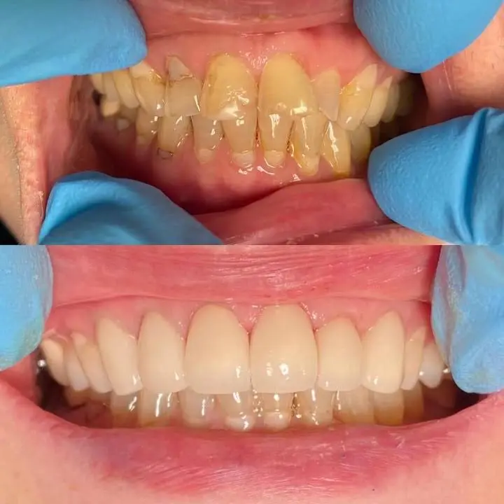 Zen Dental